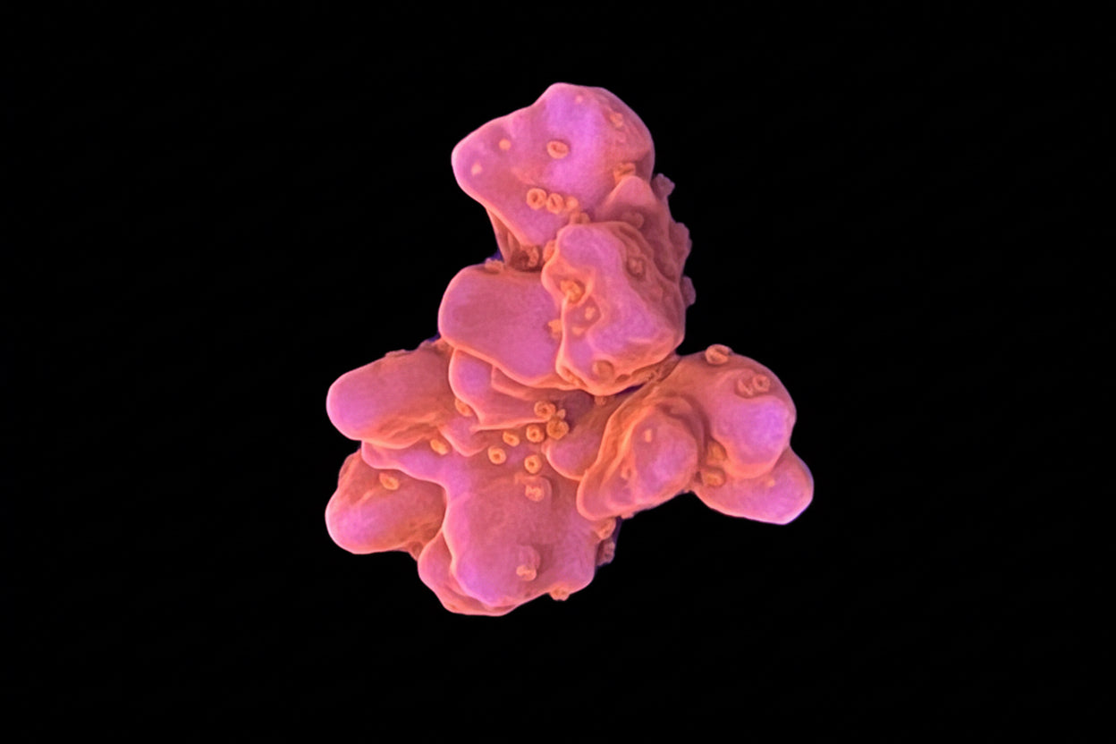Montipora Setosa
